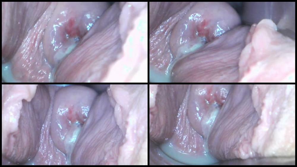 18 01 14 Webcam Teen Milly17 Speculum Examination