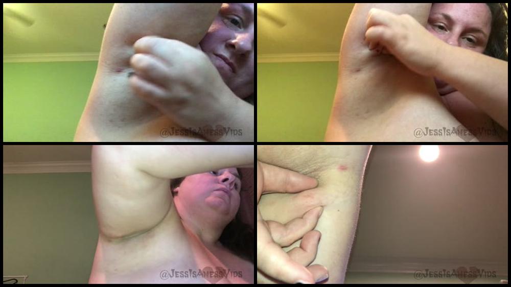 Jessisamessvids My 1St Acnephilia Vid