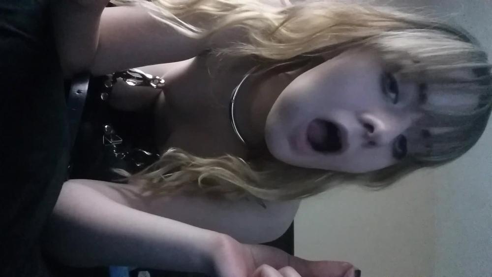 Jessica Kay All Braces