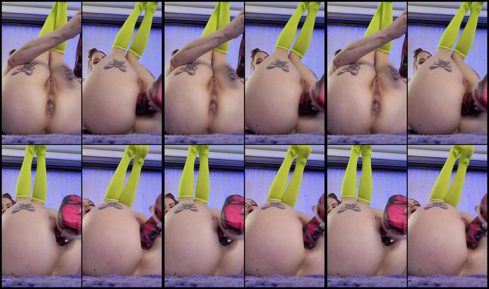Calista Melissa 10 05 2022 2450850669 Echo Anal
