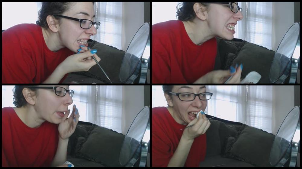 Canadiansammy Sammy Candidly Scrapes Her Teeth 2015