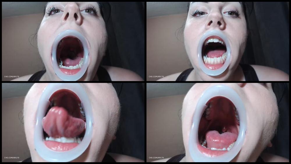 Booty4U Dental Mouth Opener