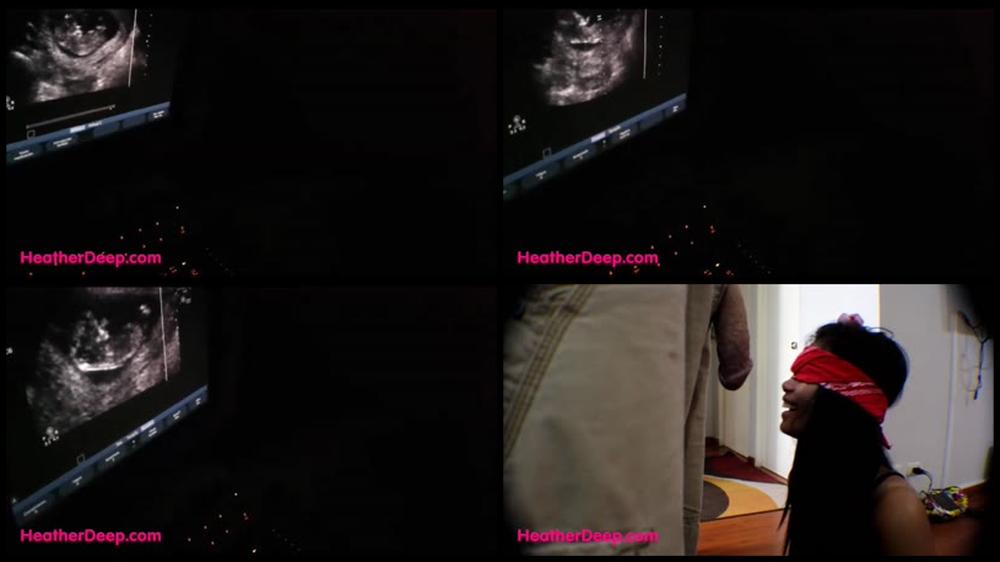12 Weeks Pregnant Heather Deep Thai Teen Gets Facial After Ultrasound