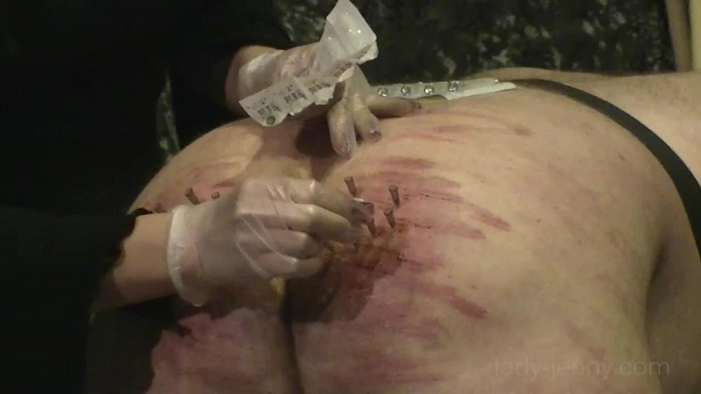 Needles Into The Ass