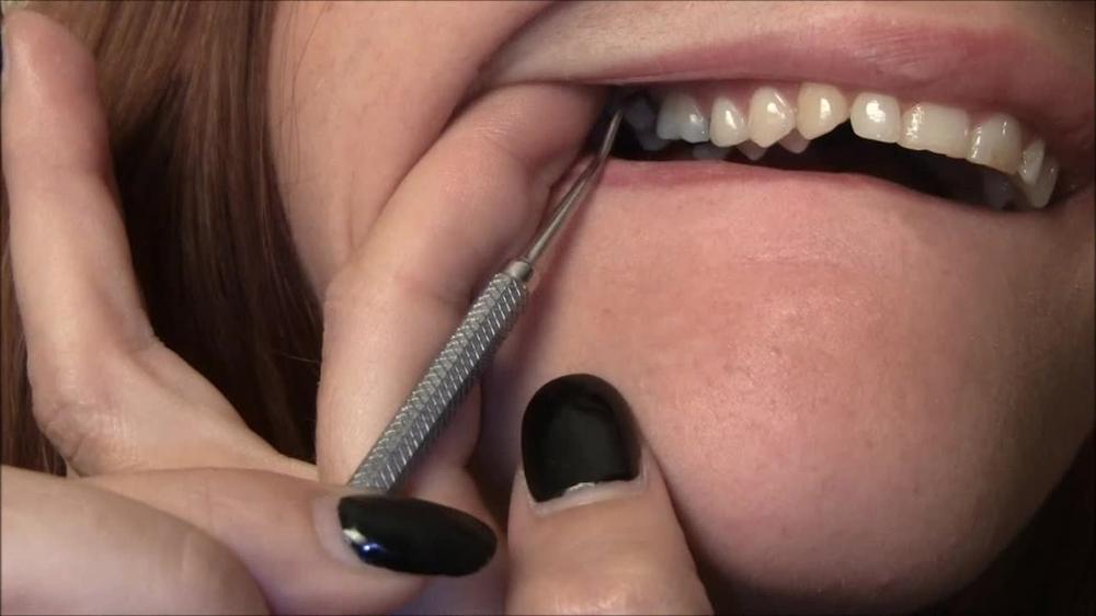 Brendas-Dental-Inspection