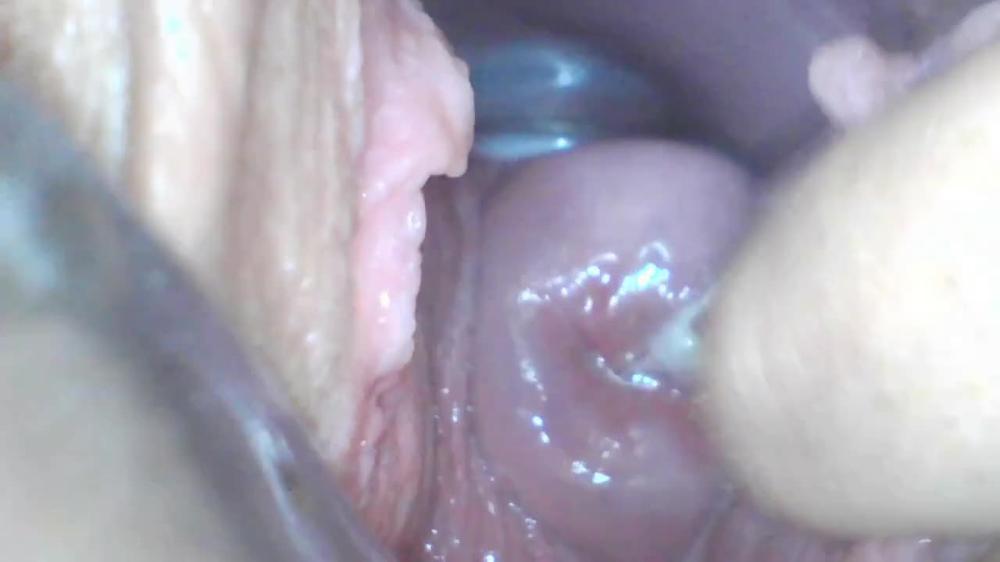 18-01-14 Webcam Teen Milly17 Speculum Examination