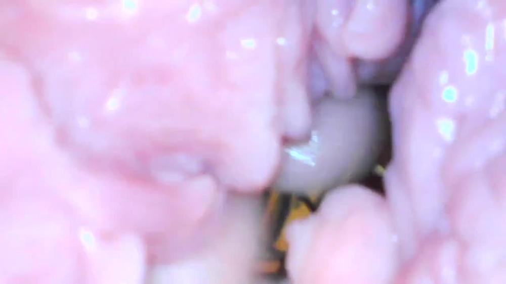 Milly17 Endoscope Play Part