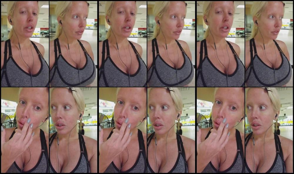 Alurajenson2011 10 05 2017 1367913 I Figured Out How I Bruised My Face Hehehe