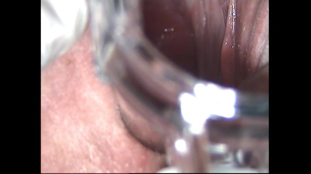Kinkyporncpl Gyno Roleplay Speculum Inside Pussy View