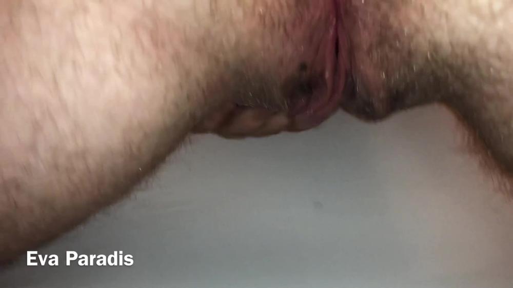 2018 11313492