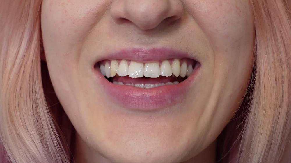Skyebaeby Square Lip Fetish Manyvids