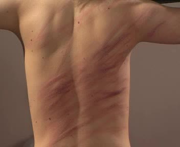 Mood Pictures - Judicial Punishment