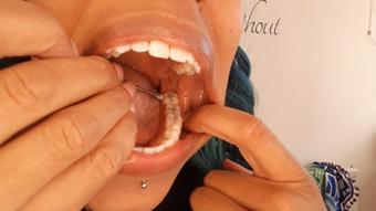 Mouth views and teeth scraping - April 15, 2021