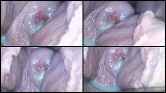 18 01 14 Webcam Teen Milly17 Speculum Examination