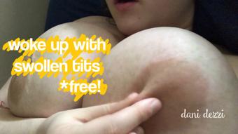 woke up with swollen tits - May 06, 2019