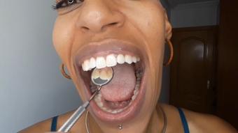 a quick teeth tour - July 29, 2021