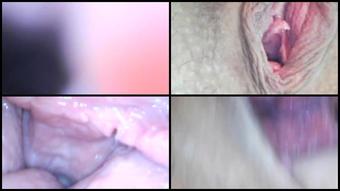 Milly17 Endoscope Play Part