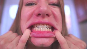 Teeth Fetish Healthy Crooked Caries