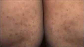 Bcmxxx_My-Dream-Nurse-Pt3