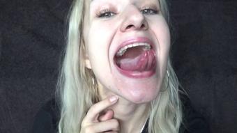Mouth Exam