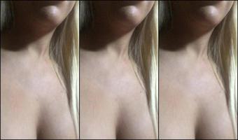 2017 425976