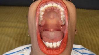 My mouth wide open for you - May 31, 2022