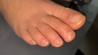 NATURAL TOES STARE - July 01, 2023