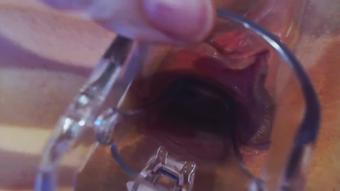 I use a Spekulum  Pussy close up