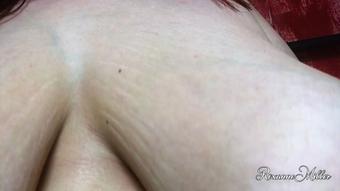 Stretchmarks of life and love