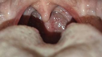 Macro mouth tour - April 05, 2023