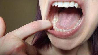 Dental Mouth Exploration