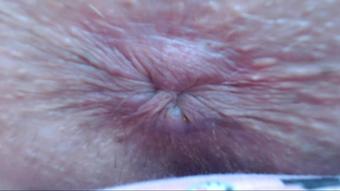 Cuteblonde666 Anal Pulsing Dirty Tight Asshole