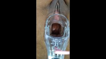 Xamy 97 Nice View Of A Speculum In My Big Ass