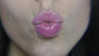 Kisses - November 23, 2015