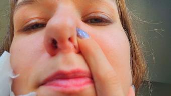 Snotty Flu Nostrils