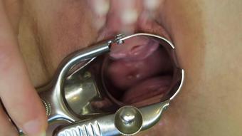 Speculum Pussy Spreading Amp Pee