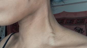 Neck veins - March 26, 2021