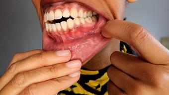 A Tour of My Colossal Mouth - March 29, 2022