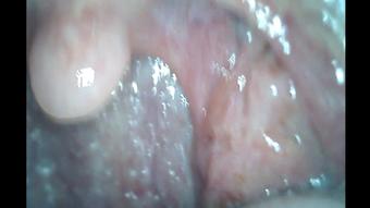 Dustin & Toby Endoscope Mouth Tour
