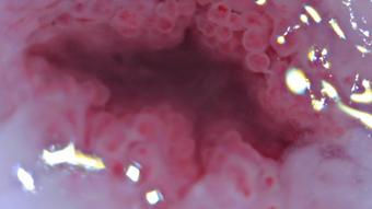 Cervix Closeup Heartbeat 4K - Nov 16, 2021