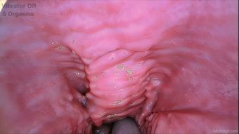 Pulsing Gspot 6 Orgasms - Jul 6, 2023