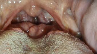 Huge Mouth Tour - May 04, 2023
