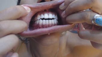 My big toothy gob - June 29, 2020