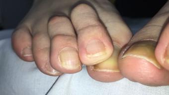 UNPOLISHED TOES CLOSE UP - October 30, 2023