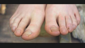 Dirty Feet and Long Toes - July 06, 2021