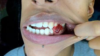 my sharp lethal teeth - January 08, 2022