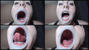 Booty4U Dental Mouth Opener