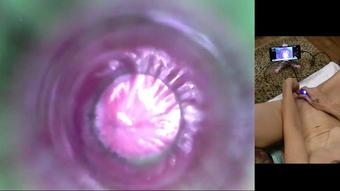 Sounding rod POV