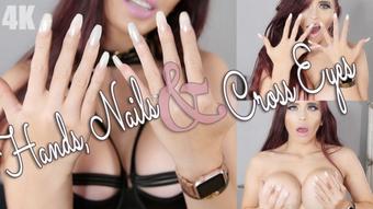 Kimberleyjx Hands Nails And Cross Eyes
