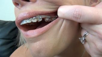 DAISY DAWSON BRACES MOUTH TOUR - October 01, 2023